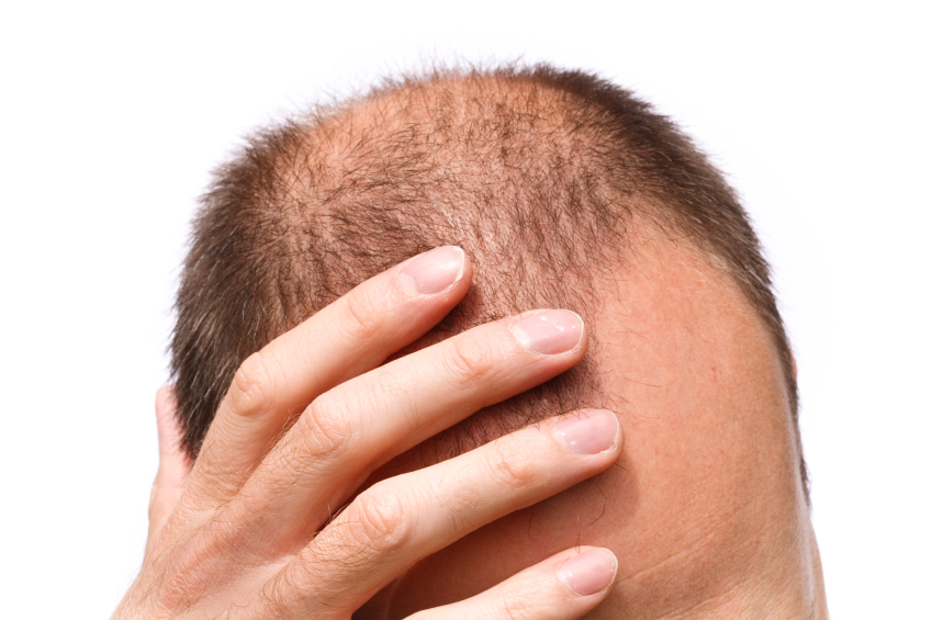 regrow hair from stress